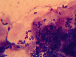 Microscopic view of yeast in a dog's ear