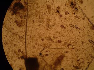 Demodex mites from a dog's skin